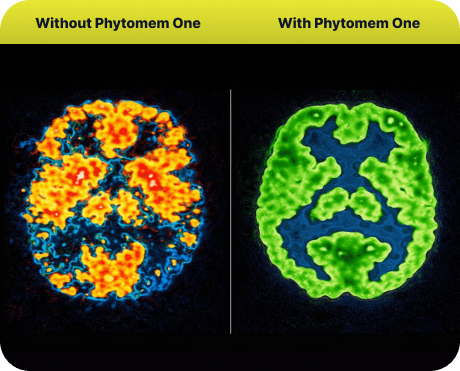 Brain before and after Phytomem One support